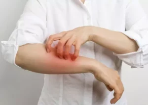 Can You Get Scabies From Gardening