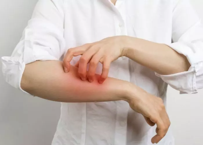 Can You Get Scabies From Gardening